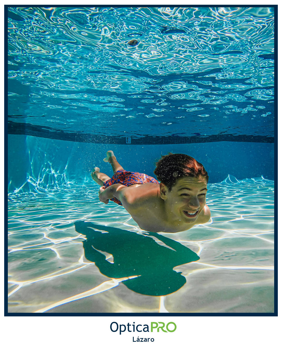 Conjuntivitis en verano: cómo prevenirla y cuándo acudir al especialista